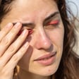 Eyelid Dermatitis Symptoms: What to Look For and Why It Happens